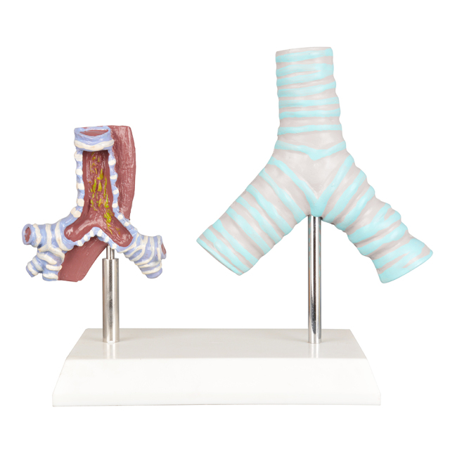 Healthy vs Smoker Trachea Model