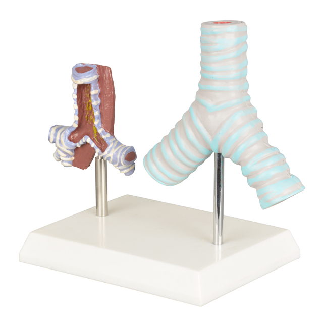 Healthy vs Smoker Trachea Model
