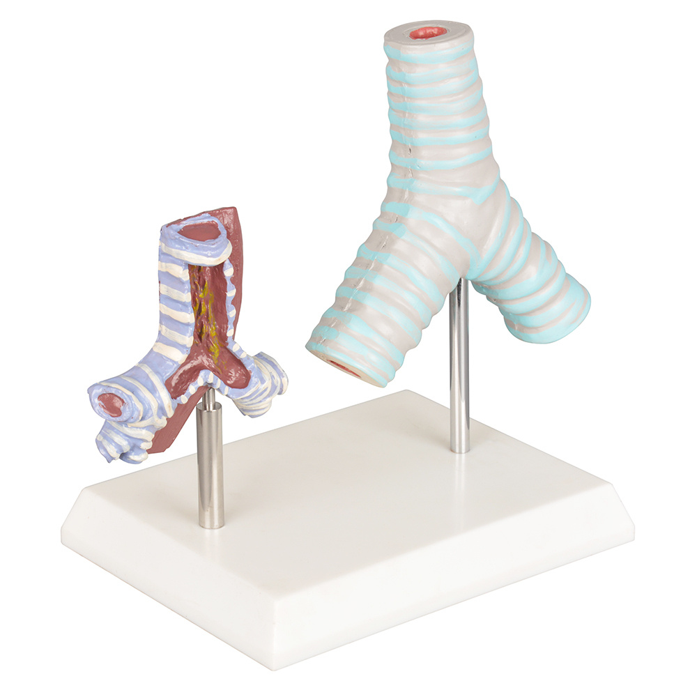 Healthy vs Smoker Trachea Model