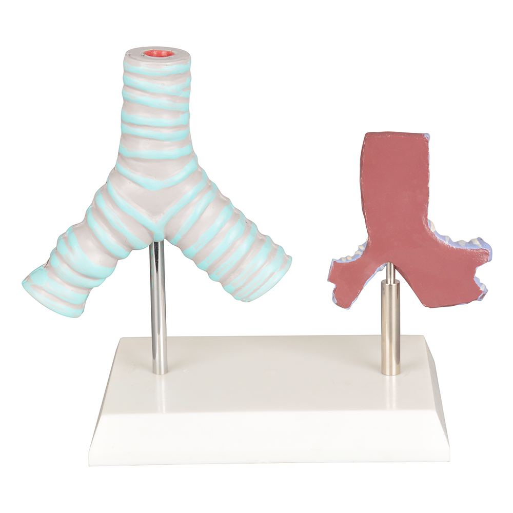 Healthy vs Smoker Trachea Model
