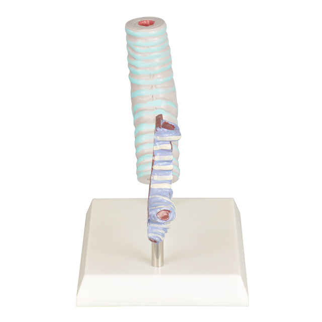 Healthy vs Smoker Trachea Model