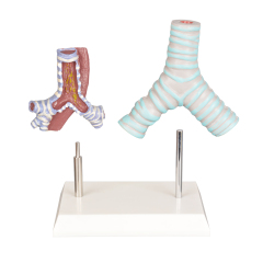 Healthy vs Smoker Trachea Model