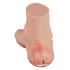 Mild Diabetic Foot Model