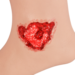 Silicone Sleeve Gunshot Wound Model