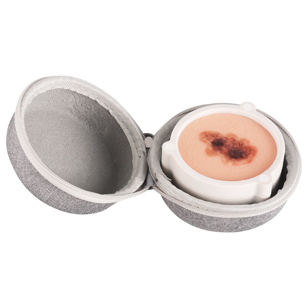 Silicone Skin Cancer Model