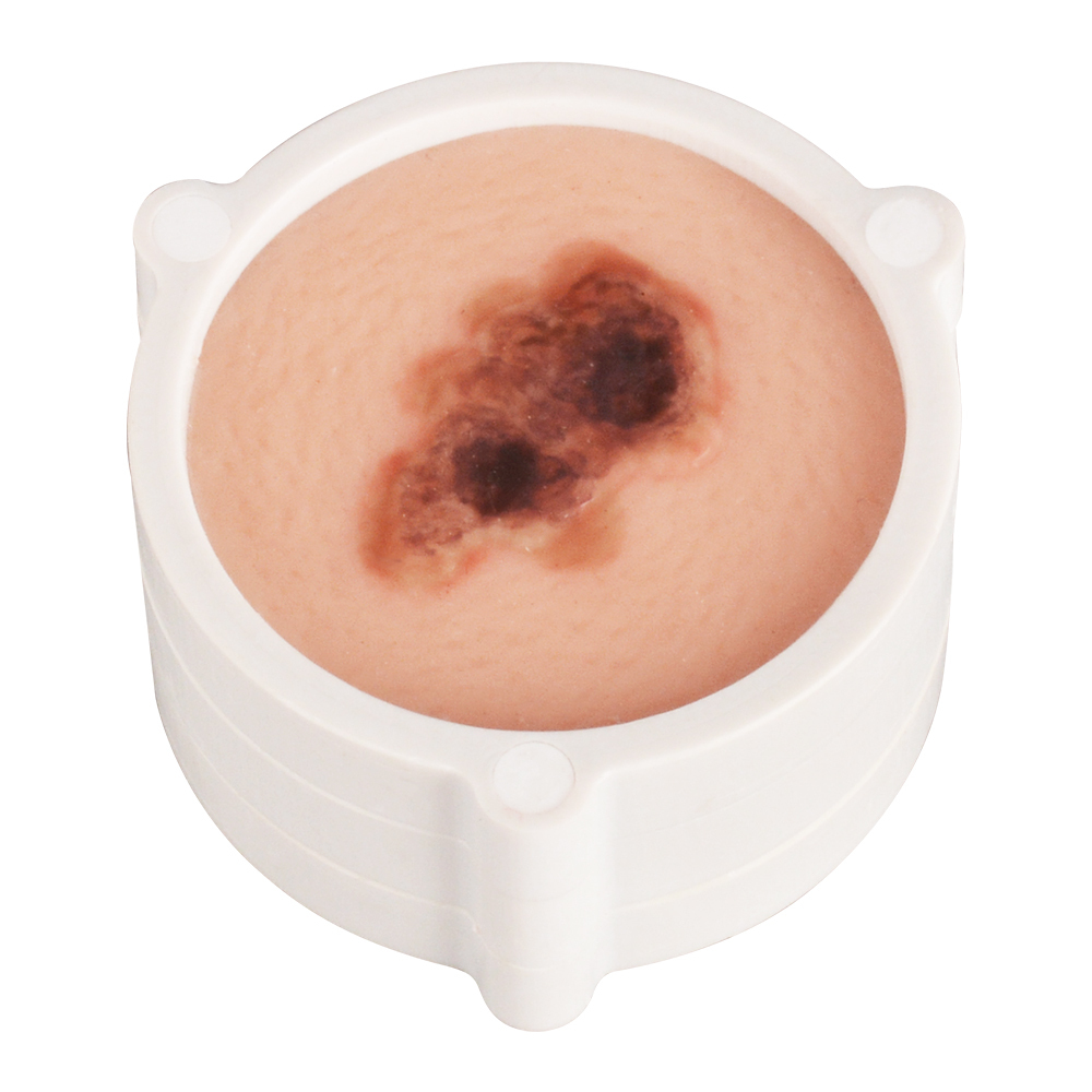 Silicone Skin Cancer Model