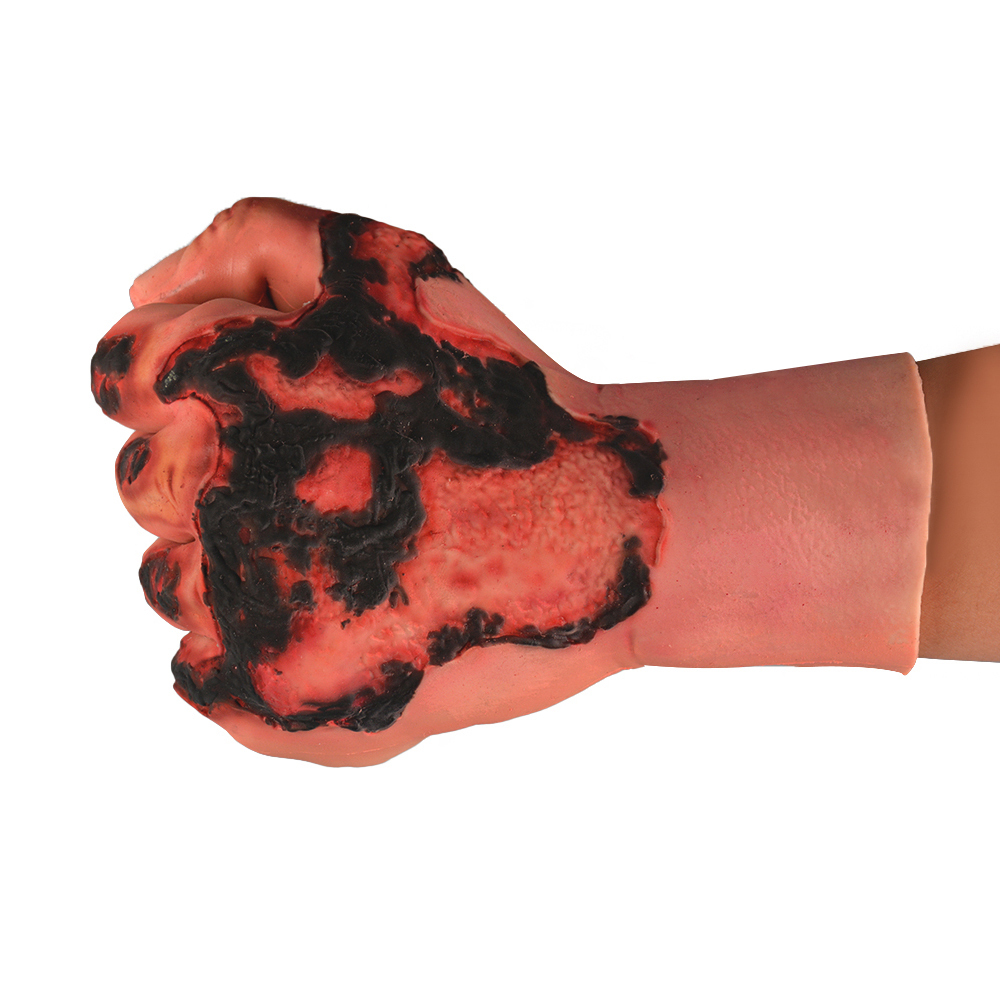Wearable Burn Wound Hand Simulator