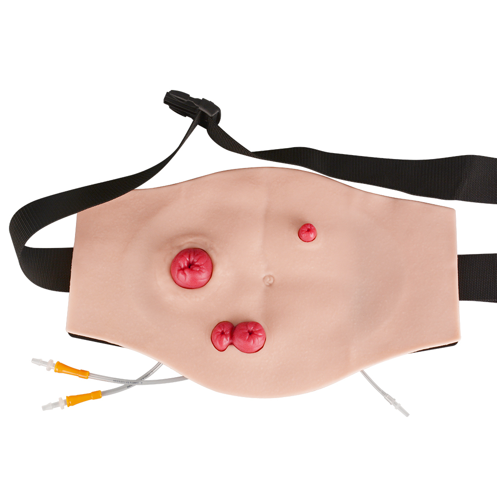 Belly-Worn Wearable Ostomy Care Model