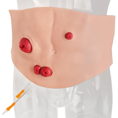 Belly-Worn Wearable Ostomy Care Model