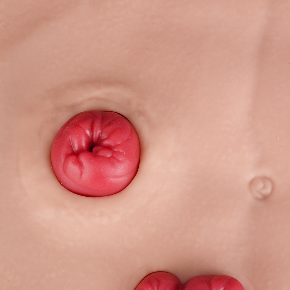 Belly-Worn Wearable Ostomy Care Model
