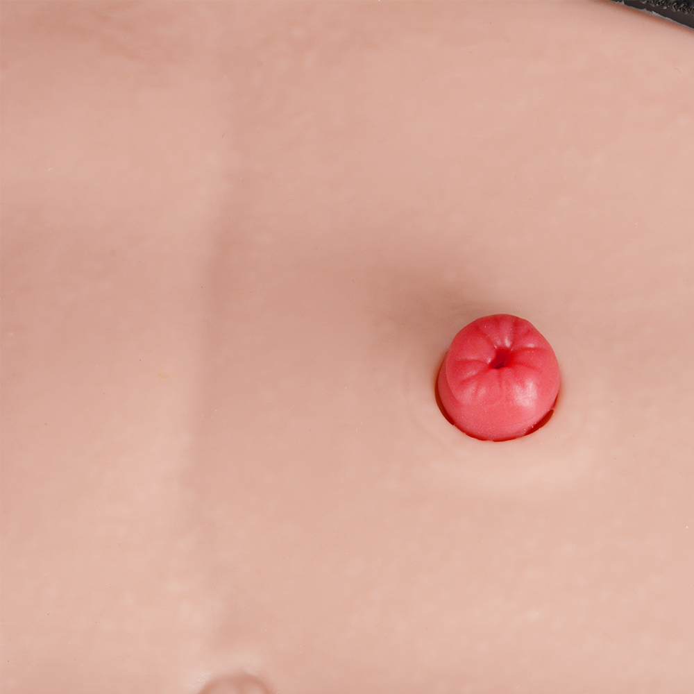 Belly-Worn Wearable Ostomy Care Model
