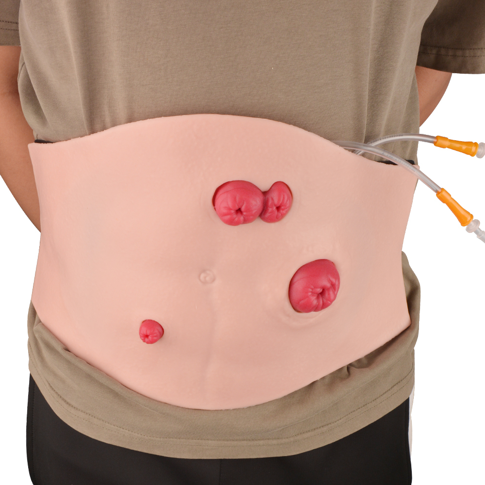 Belly-Worn Wearable Ostomy Care Model