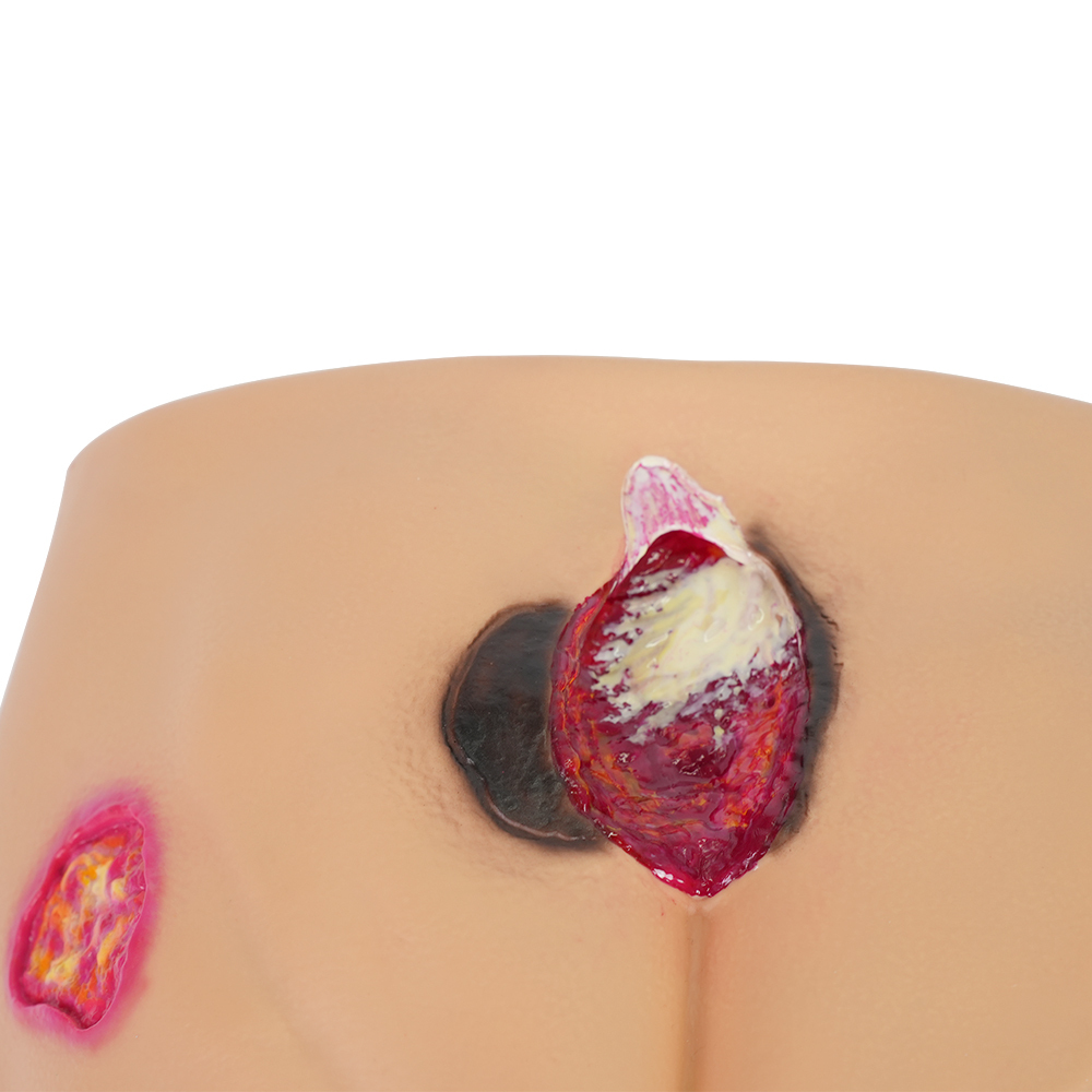 PVC Full Buttocks Pressure Ulcer/Bedsore Simulator