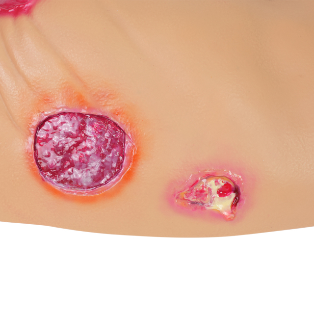 PVC Full Buttocks Pressure Ulcer/Bedsore Simulator