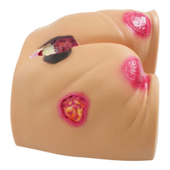 PVC Full Buttocks Pressure Ulcer/Bedsore Simulator
