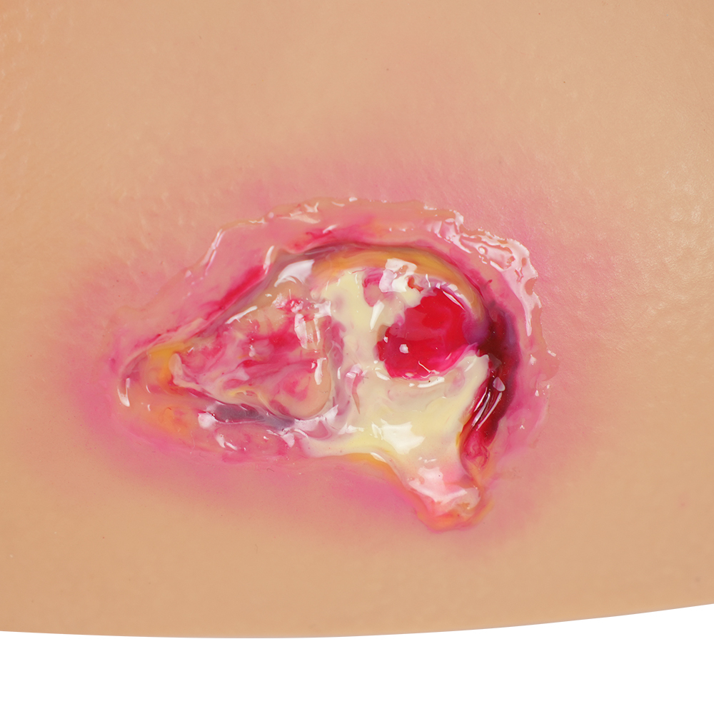 PVC Full Buttocks Pressure Ulcer/Bedsore Simulator