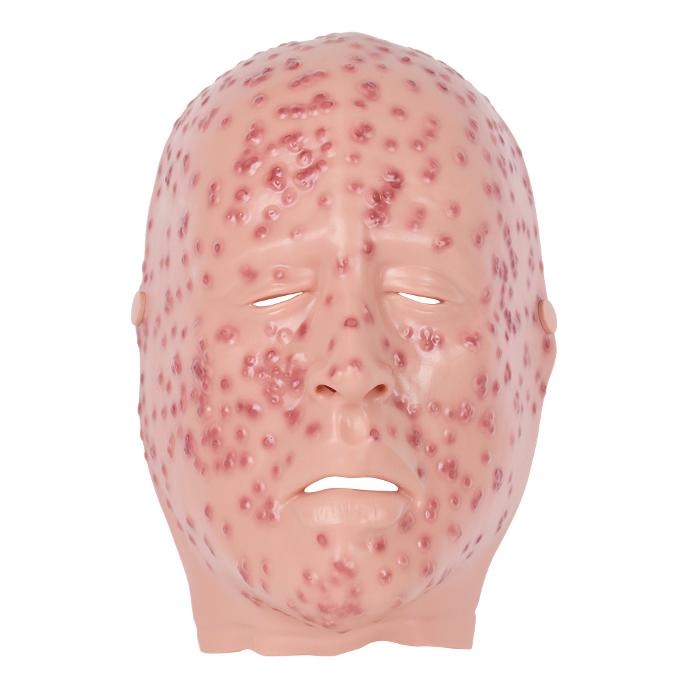 Severe Smallpox Face Training Simulator