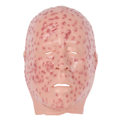 Severe Smallpox Face Training Simulator