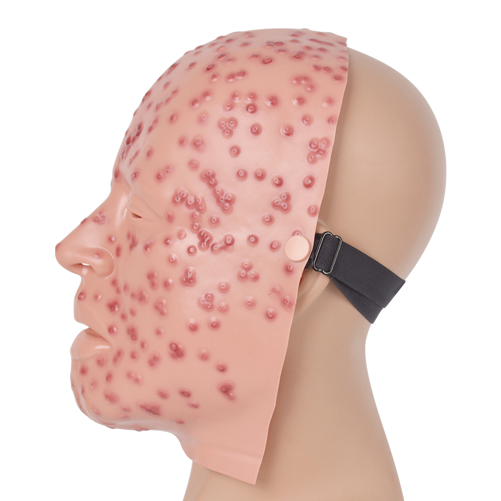 Severe Smallpox Face Training Simulator
