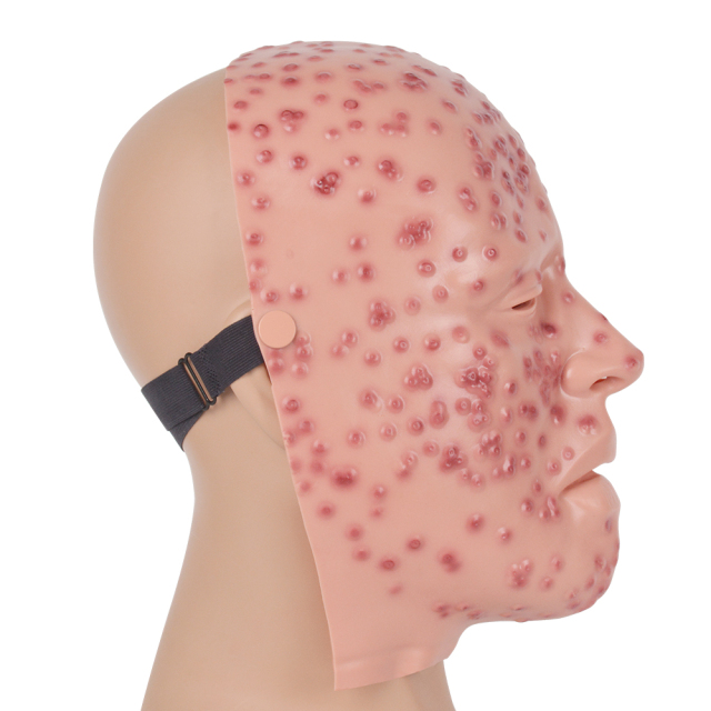 Severe Smallpox Face Training Simulator