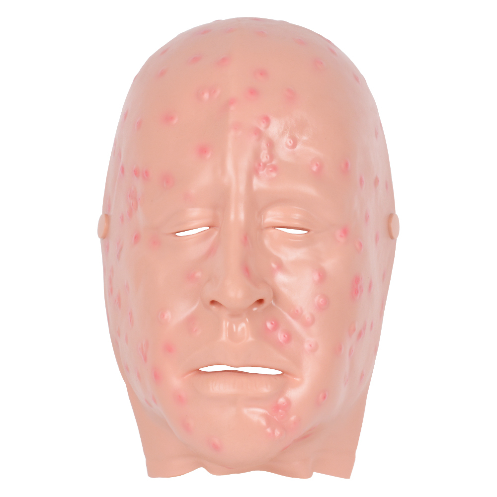Mild Smallpox Facial Lesion Training Mask