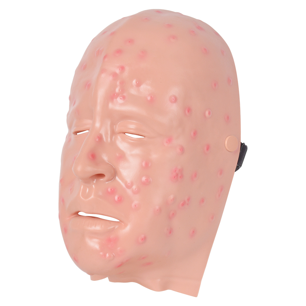 Mild Smallpox Facial Lesion Training Mask