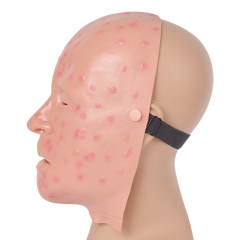 Mild Smallpox Facial Lesion Training Mask