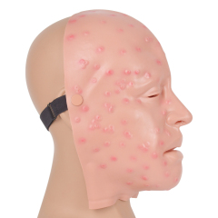 Mild Smallpox Facial Lesion Training Mask