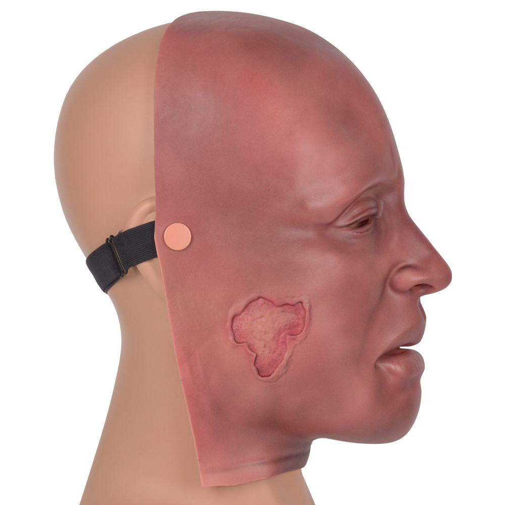 Wearable Minor Burn Face Training Mask