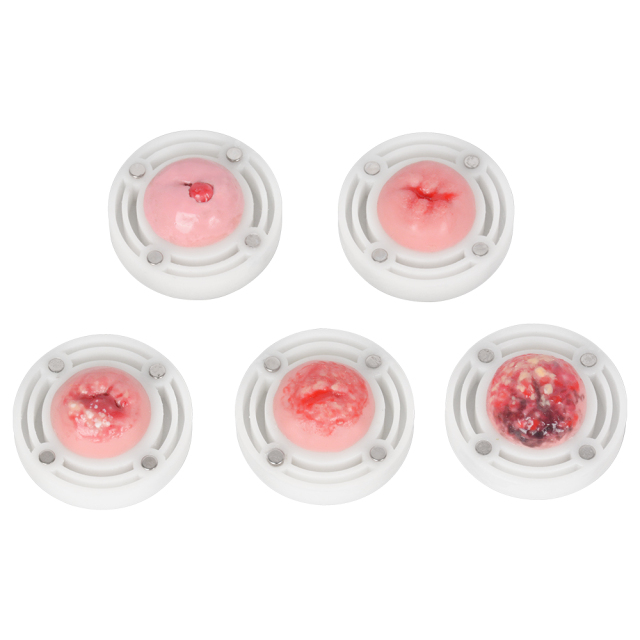 Gynecological Examination Model with Interchangeable Cervix