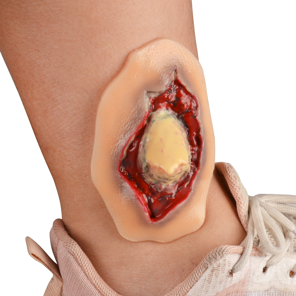 Silicone Ankle Fracture Wound Model