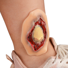 Silicone Ankle Fracture Wound Model