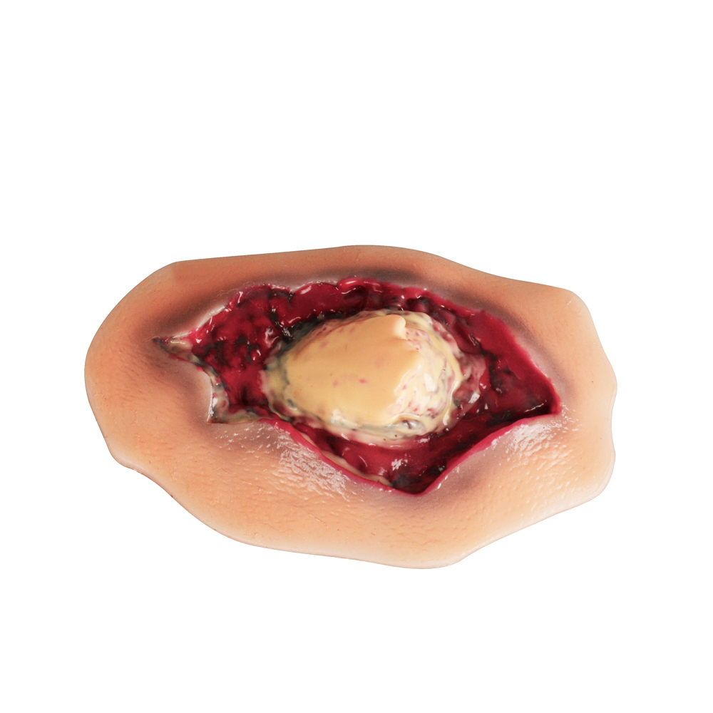 Silicone Ankle Fracture Wound Model