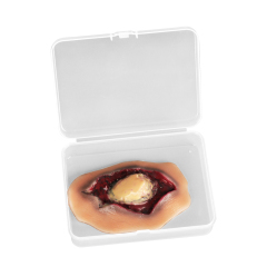 Silicone Ankle Fracture Wound Model