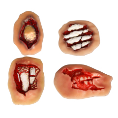 Adhesive Hand Trauma Simulation Model