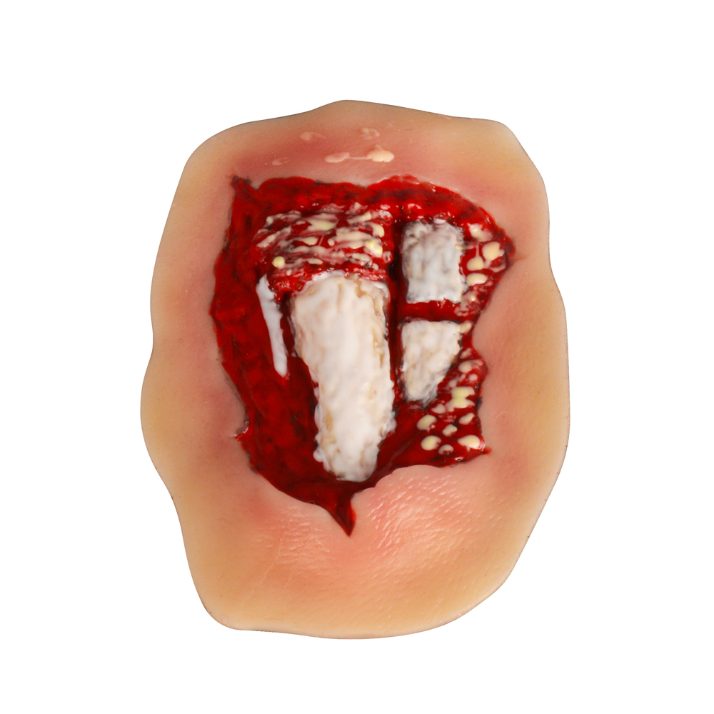 Adhesive Hand Trauma Simulation Model