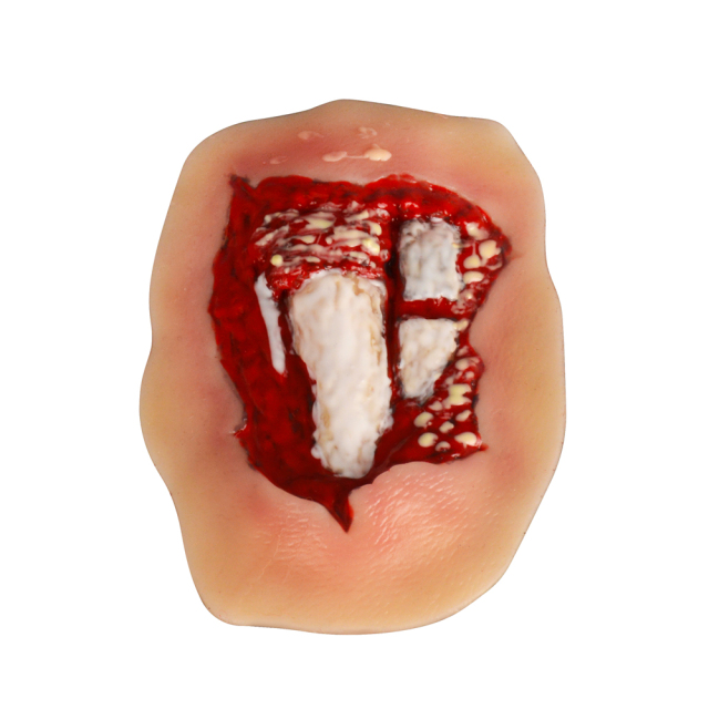 Adhesive Hand Trauma Simulation Model