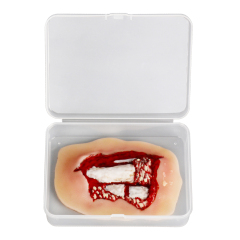Adhesive Hand Trauma Simulation Model