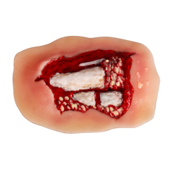Adhesive Hand Trauma Simulation Model