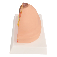 Pathological Breast Cross-Section Model