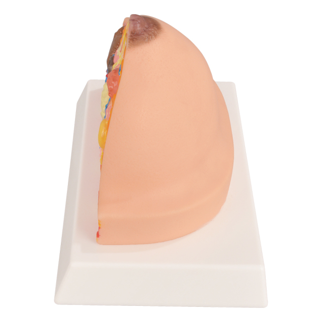 Pathological Breast Cross-Section Model