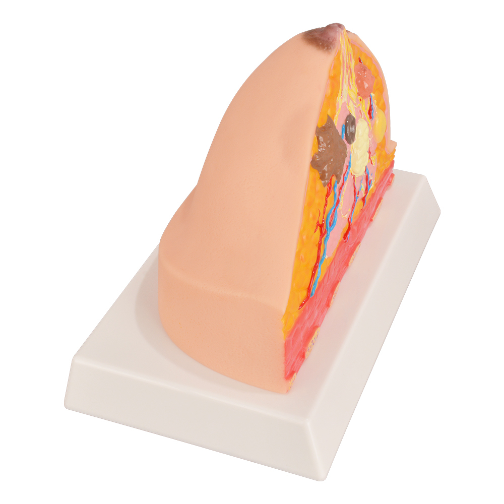 Pathological Breast Cross-Section Model