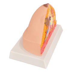 Pathological Breast Cross-Section Model