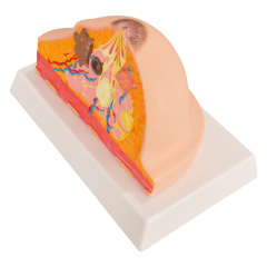 Pathological Breast Cross-Section Model