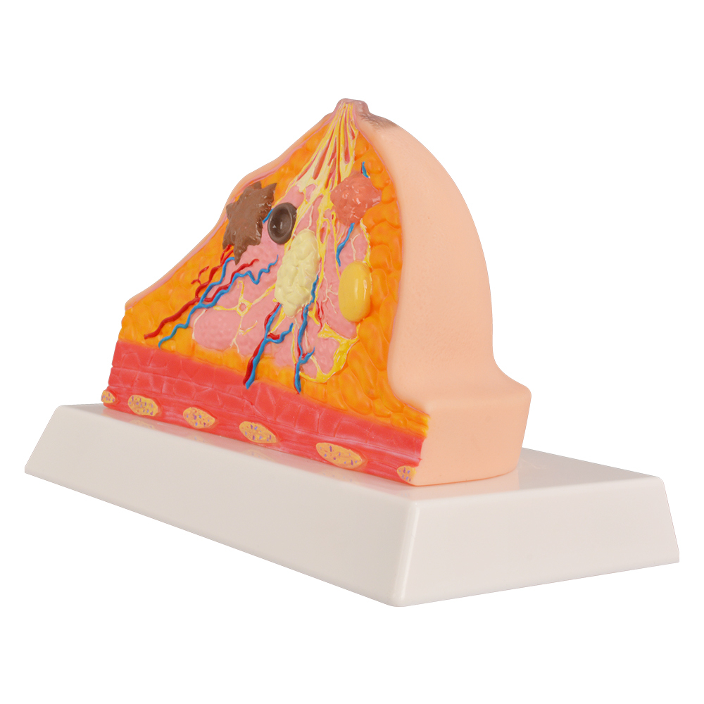 Pathological Breast Cross-Section Model