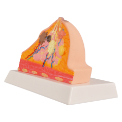 Pathological Breast Cross-Section Model