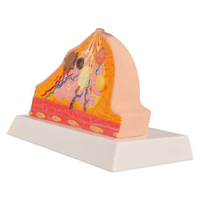 Pathological Breast Cross-Section Model