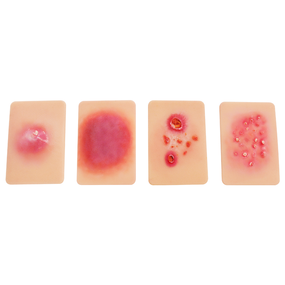 Bacterial Infection Display Cards(4 Types)