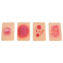 Bacterial Infection Display Cards(4 Types)