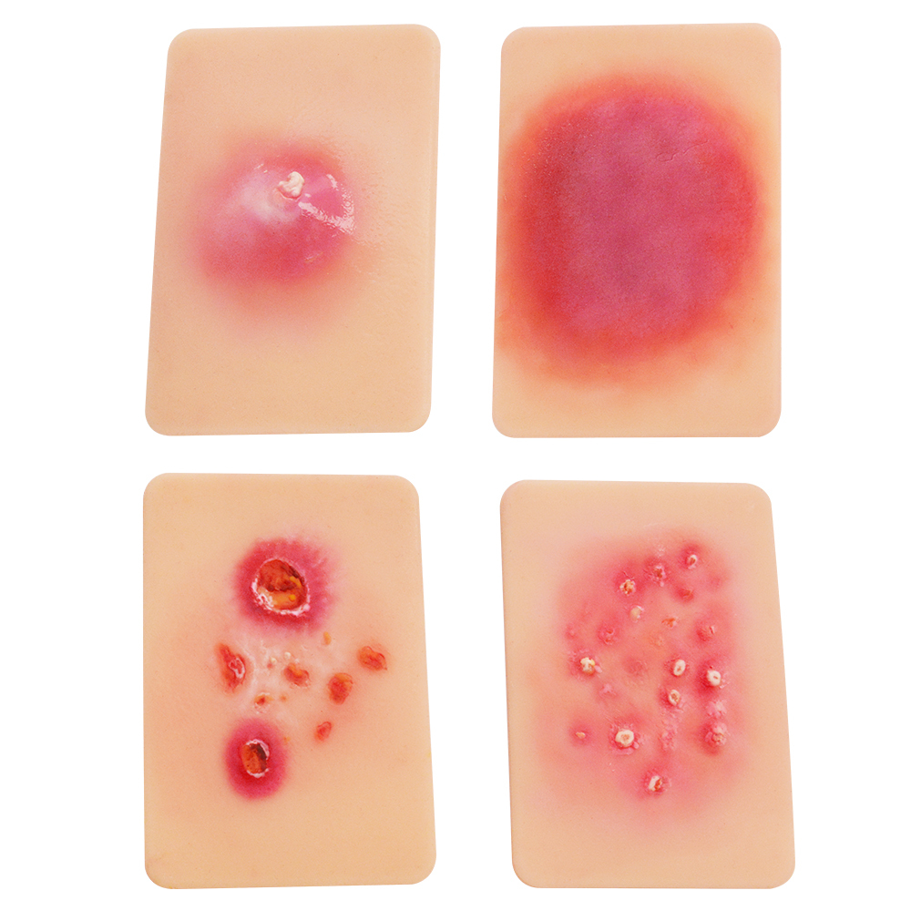 Bacterial Infection Display Cards(4 Types)
